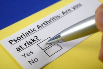 Doctor Clip Board Asking if the Patient is at Risk for Psoriatic Arthritis